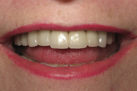demo image1