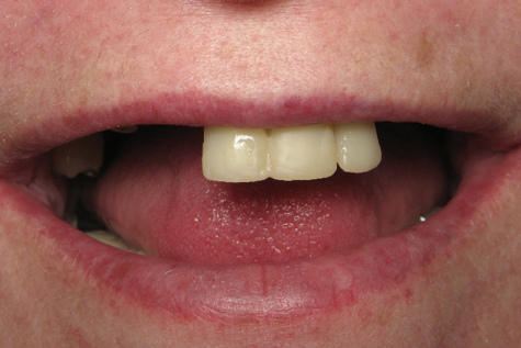 demo image2