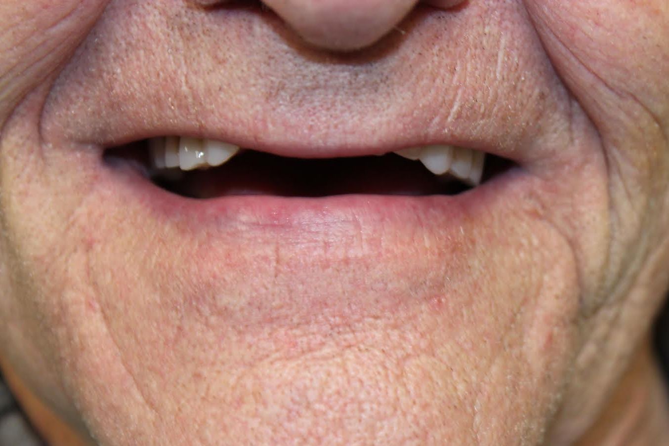 demo image2