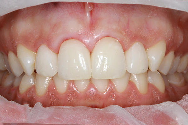 demo image1