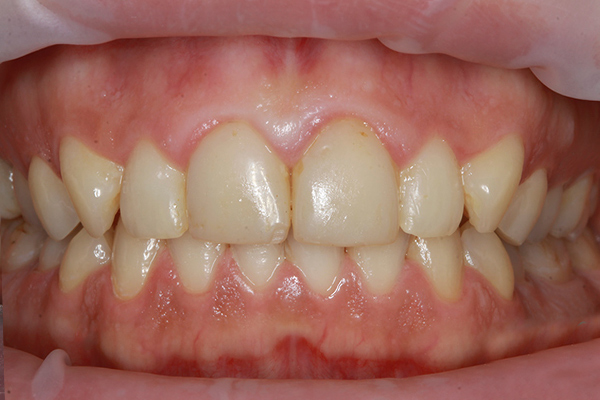 demo image2