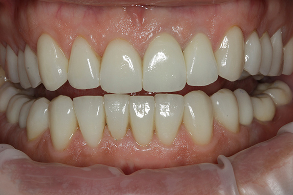 demo image1