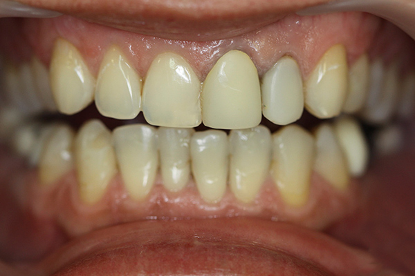 demo image2