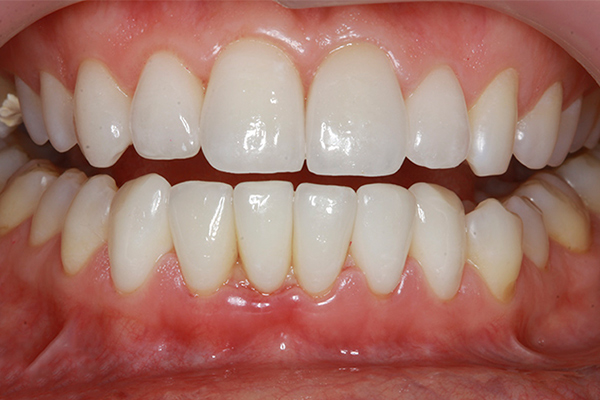 demo image1