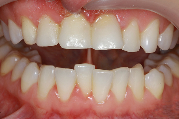 demo image2