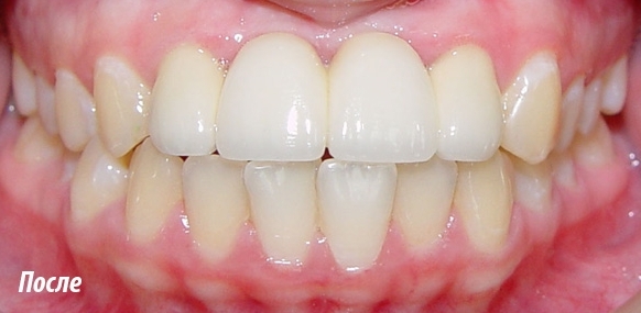 demo image1