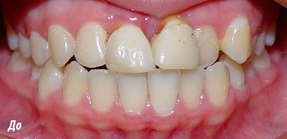 demo image2