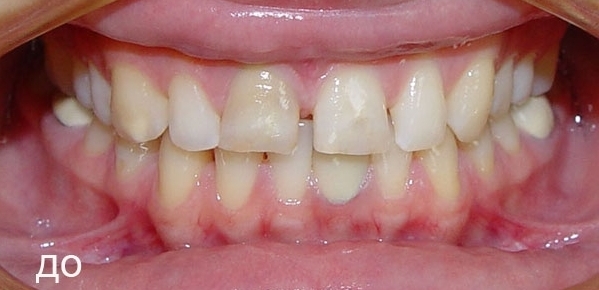 demo image2